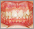 先天性欠如歯【永久歯の先天性欠如】の症例2
