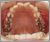 上下顎前突症【出っ歯】の症例8