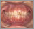 外傷歯の症例1
